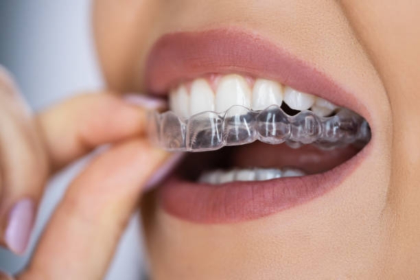 Best Dentist Near Me in Khajaguda Hyderabad