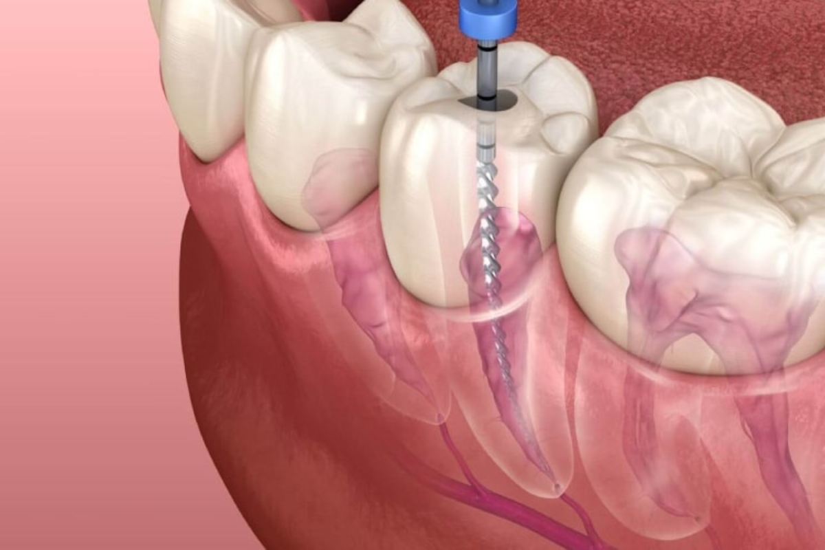 best dental clinic in Khajaguda