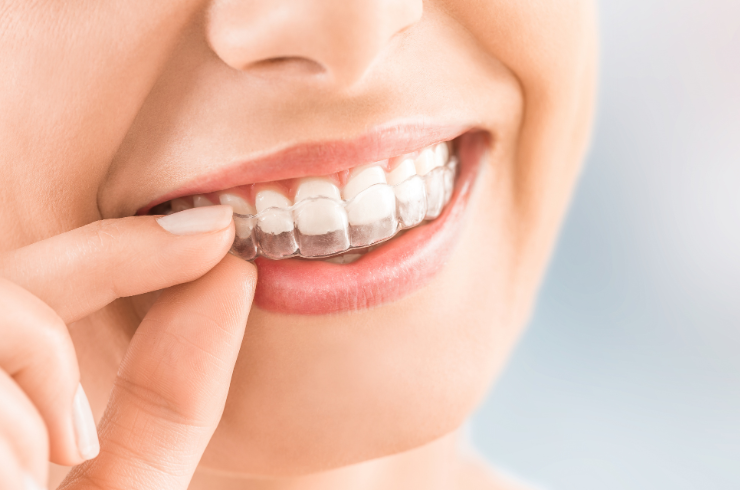 Braces & Clear Aligners